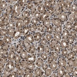 RBM5 Antibody, Novus Biologicals:Antibodies:Primary Antibodies