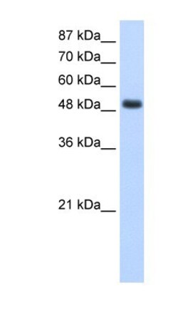 RBMS1 Antibody, Novus Biologicals 20&mu;L; Unlabeled:Antibodies, Polyclonal
