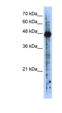 RBMS2 Antibody, Novus Biologicals 100&mu;L; Unlabeled:Antibodies, Polyclonal