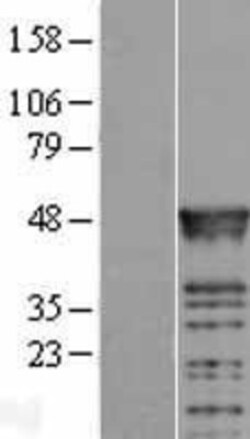 Novus Biologicals&trade;&nbsp;RBMS2 Overexpression Lysate