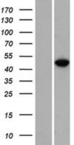 Novus Biologicals&trade;&nbsp;RBMS3 Overexpression Lysate