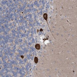 RBMS3 Antibody, Novus Biologicals 25 &mu;L; Unlabeled:Antibodies, Polyclonal