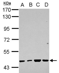 RBMY1F Antibody, Novus Biologicals 0.1mL; Unlabeled:Antibodies, Polyclonal