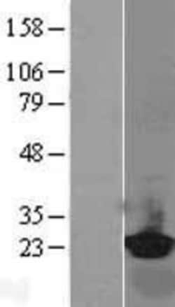 Novus Biologicals™ RBP4/Retinol-Binding Protein 4 Overexpression Lysate
