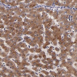 RBP4/Retinol-Binding Protein 4 Antibody, Novus Biologicals 25 &mu;L; Unlabeled:Antibodies,