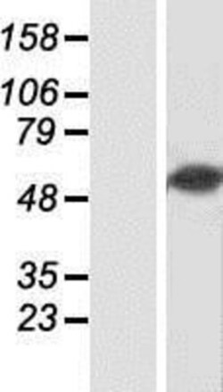 Novus Biologicals&trade;&nbsp;csl/RBPJK Overexpression Lysate