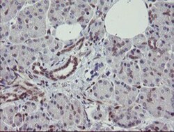 RBPMS Antibody (OTI3B7), Novus Biologicals 0.1mL; Unlabeled:Antibodies,