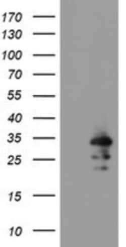 RBPMS Antibody (OTI3B7), Novus Biologicals 0.1mL; Unlabeled:Antibodies,