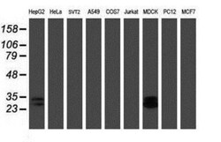 RBPMS Antibody (OTI3B7), Novus Biologicals 0.1mL; Unlabeled:Antibodies,