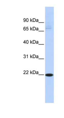 RBPMS2 Antibody, Novus Biologicals 100 &mu;L | Buy Online | Novus Biologicals | Fisher Scientific