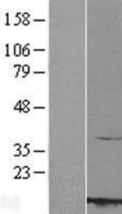 Novus Biologicals&trade;&nbsp;RBX1 Overexpression Lysate