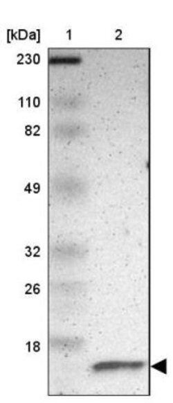 RBX1 Antibody, Novus Biologicals 0.1mL; Unlabeled:Antibodies, Polyclonal