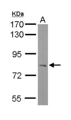 RC74 Antibody, Novus Biologicals 0.1mL; Unlabeled:Antibodies, Polyclonal