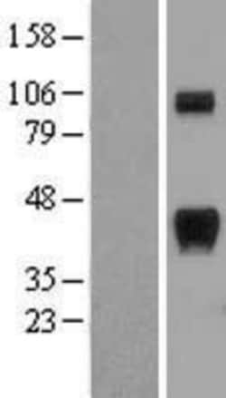 Novus Biologicals&trade;&nbsp;RCAN1 Overexpression Lysate