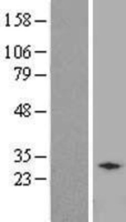 Novus Biologicals™ RCAN2 Overexpression Lysate