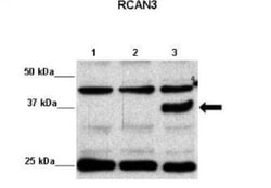RCAN3 Antibody, Novus Biologicals:Antibodies:Primary Antibodies