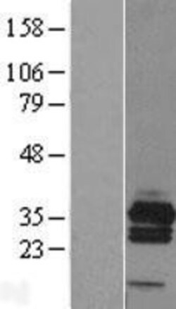 Novus Biologicals&trade;&nbsp;RCAN3 Overexpression Lysate