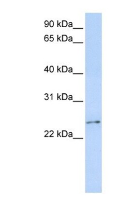 RCAN3 Antibody, Novus Biologicals:Antibodies:Primary Antibodies