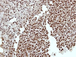 RCBTB1 Antibody, Novus Biologicals 0.1mL; Unlabeled:Antibodies, Polyclonal