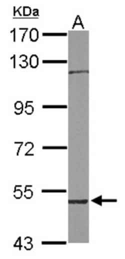 RCBTB1 Antibody, Novus Biologicals 0.1mL; Unlabeled:Antibodies, Polyclonal