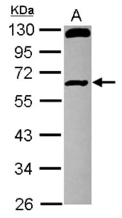 RCBTB1 Antibody, Novus Biologicals 0.1 mL | Buy Online | Novus Biologicals | Fisher Scientific