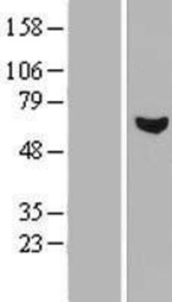 Novus Biologicals&trade;&nbsp;RCBTB1 Overexpression Lysate