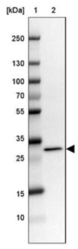 RCBTB2 Antibody, Novus Biologicals 0.1mL; Unlabeled:Antibodies, Polyclonal