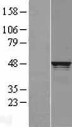 Novus Biologicals&trade;&nbsp;RCC1 Overexpression Lysate