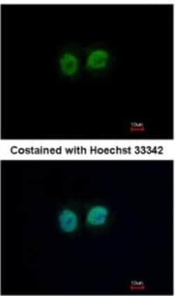 RCC2 Antibody, Novus Biologicals 0.1mL; Unlabeled:Antibodies, Polyclonal