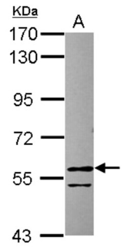 RCC2 Antibody, Novus Biologicals 0.1mL; Unlabeled:Antibodies, Polyclonal