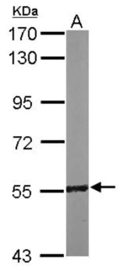 RCC2 Antibody, Novus Biologicals 0.1mL; Unlabeled:Antibodies, Polyclonal
