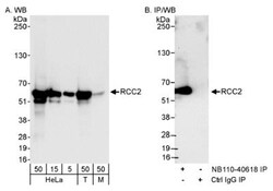RCC2 Antibody, Novus Biologicals 0.1mL; Unlabeled:Antibodies, Polyclonal