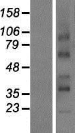 Novus Biologicals&trade;&nbsp;RCE1 Overexpression Lysate