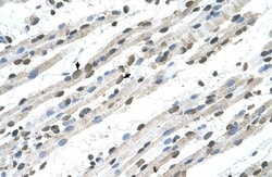 RCE1 Antibody, Novus Biologicals 0.1mg; Unlabeled:Antibodies, Polyclonal