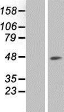 Novus Biologicals&trade;&nbsp;RCL1 Overexpression Lysate