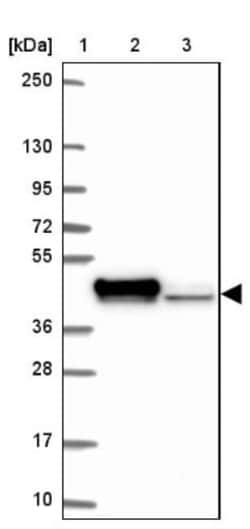 RCN1 Antibody, Novus Biologicals 0.1mL; Unlabeled:Antibodies, Polyclonal