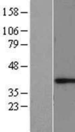 Novus Biologicals™ RCN1 Overexpression Lysate