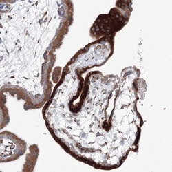 RCN1 Antibody, Novus Biologicals 0.1mL; Unlabeled:Antibodies, Polyclonal
