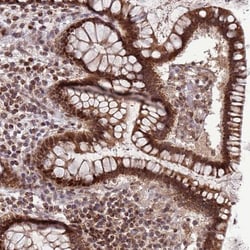 RCOR2 Antibody, Novus Biologicals 0.1mL; Unlabeled:Antibodies, Polyclonal