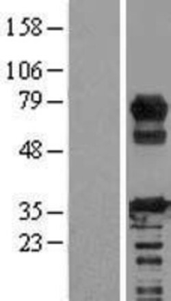Novus Biologicals&trade;&nbsp;RCSD 1 Overexpression Lysate