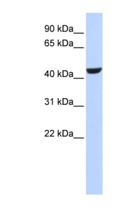 RDH16 Antibody, Novus Biologicals 100μL; Unlabeled:Antibodies, Polyclonal