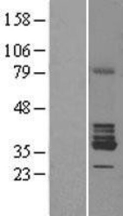 Novus Biologicals&trade;&nbsp;RDH5 Overexpression Lysate