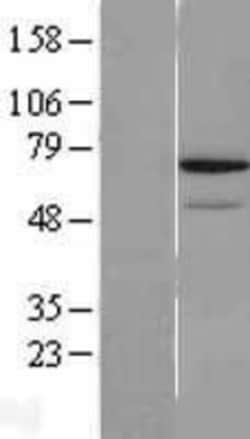 Novus Biologicals&trade;&nbsp;REC8 Overexpression Lysate