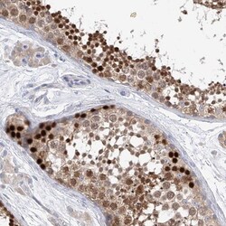 REC8 Antibody, Novus Biologicals:Antibodies:Primary Antibodies