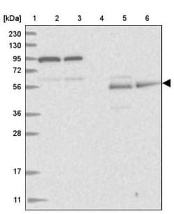 REC8 Antibody, Novus Biologicals 0.1mL; Unlabeled:Antibodies, Polyclonal
