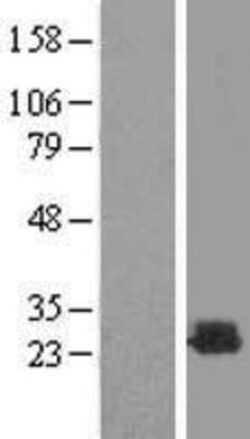 Novus Biologicals™ Recoverin Overexpression Lysate