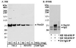 RECQ1 Antibody, Novus Biologicals 0.1 mL | Buy Online | Novus Biologicals | Fisher Scientific