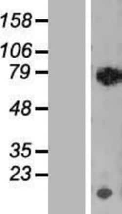 Novus Biologicals&trade;&nbsp;RECQ1 Overexpression Lysate
