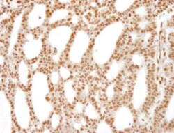 RECQ1 Antibody, Novus Biologicals 0.1 mL | Buy Online | Novus Biologicals | Fisher Scientific