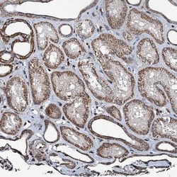 RECQ1 Antibody, Novus Biologicals 0.1mL; Unlabeled:Antibodies, Polyclonal